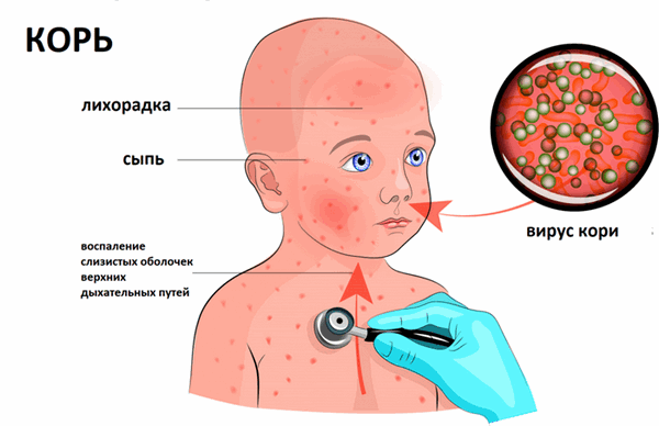 Александров Павел Андреевич, инфекционист, гепатолог, паразитолог, детский инфекционист - Санкт-Петербург