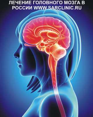 головной мозг человека, ребенка, отделы, строение, лечение головного мозга, как лечить