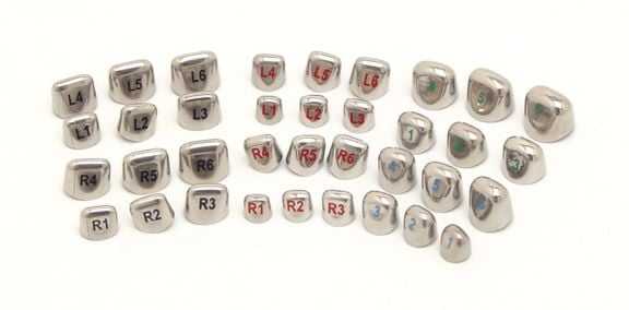 изменение прикуса коронками