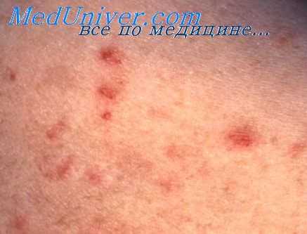 придаток кожи