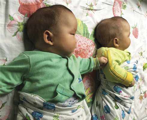 Плагиоцефалия