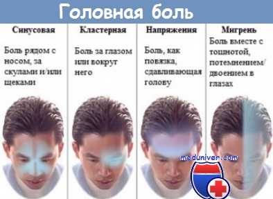 Типы головных болей