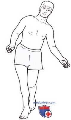 Объективное обследование при нарушении походки