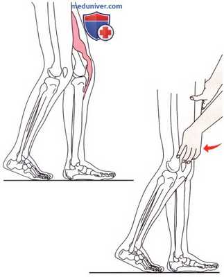 Объективное обследование при нарушении походки