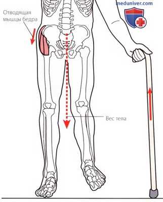 Критерии нормальной ходьбы и походки