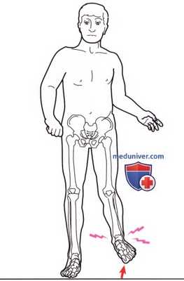 Объективное обследование при нарушении походки