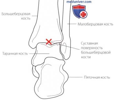 Нижняя конечность как единое целое и как опора