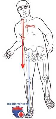Объективное обследование при нарушении походки