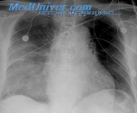 размеры тимом