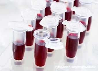 Общий анализ крови