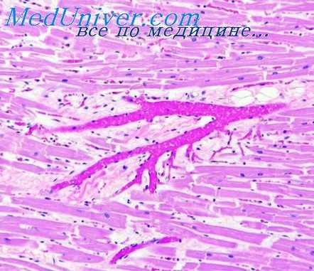 замыкающие артерии сердца