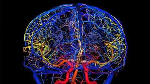  сосудов головного мозга