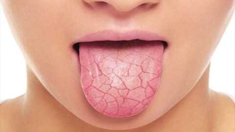 Схема расположения слюнных желёз