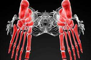 Методика магнитно-резонансной томографии при подагре