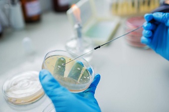 Бактериологическое исследование отделяемого из уха