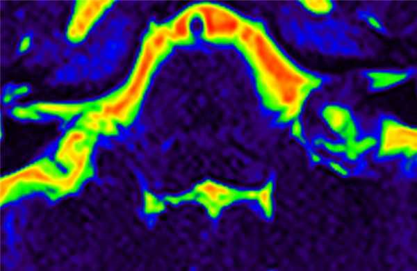 ликворрея-цвет