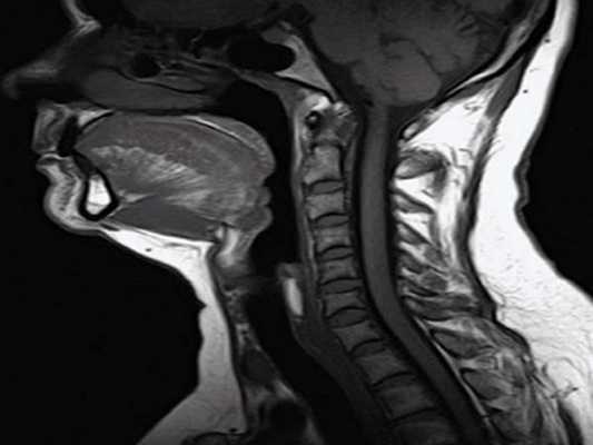 Как делают МРТ шеи