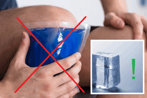 Не пользуйтесь сухим холодом, спортивные врачи советуют обычные кубики льда