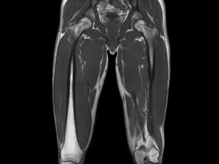 КТ мягких тканей