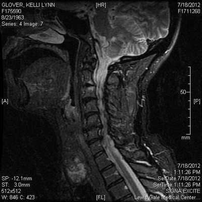 Что входит в МРТ мягких тканей шеи