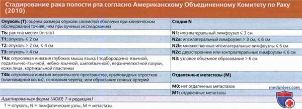КТ, МРТ при плоскоклеточном раке тела и верхушки языка