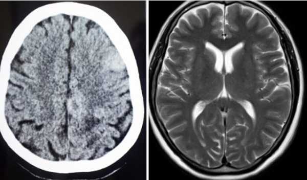 МРТ и МСКТ в чем разница