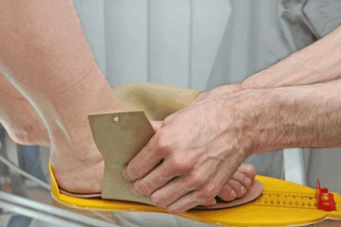 Индивидуальные стельки - важная составляющая терапии тендинита надколенника