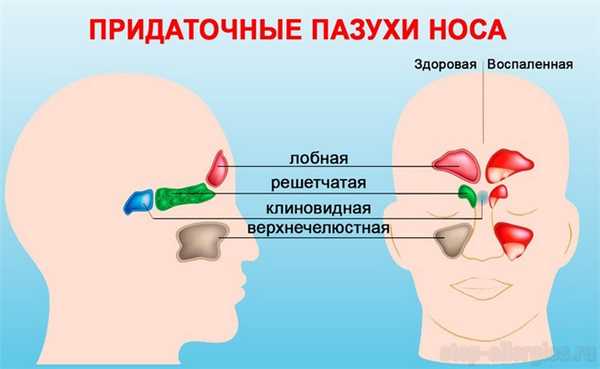 Придаточные пазухи носа