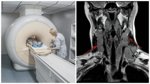 МРТ миндалин