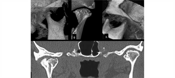 Рентген кистей рук