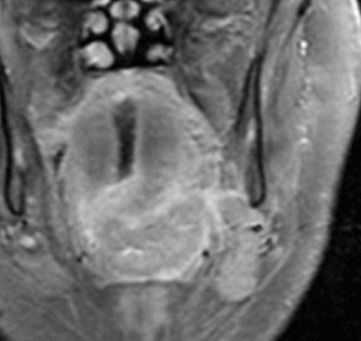 rotoglotka-submandibulyarnoe