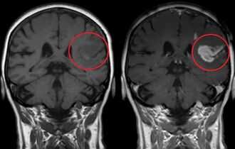 Какие контрастные вещества используют в МРТ