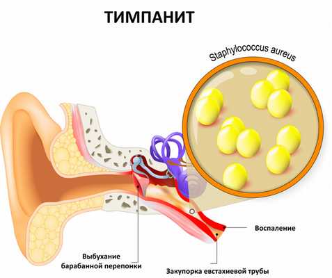 Среднее ухо.jpg