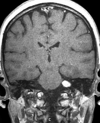 Т1-контр-кор
