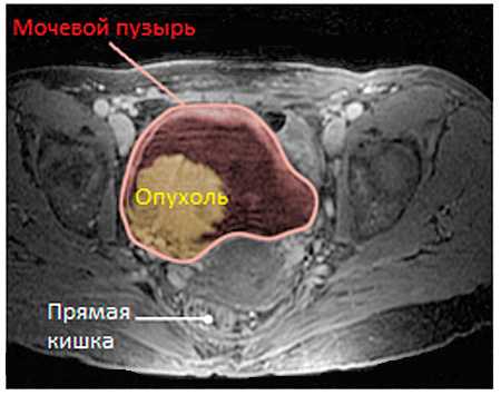 Магнитно-резонансная томография