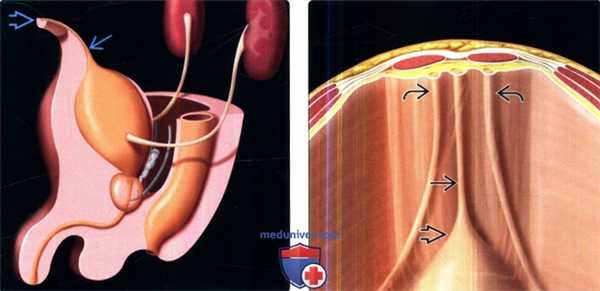 Методы лучевого обследования мочевого пузыря