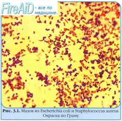 Факторы влияющие на рост бактерий. Культуральные среды для роста бактерий. Простые и сложные культуральные среды. Твердые и жидкие