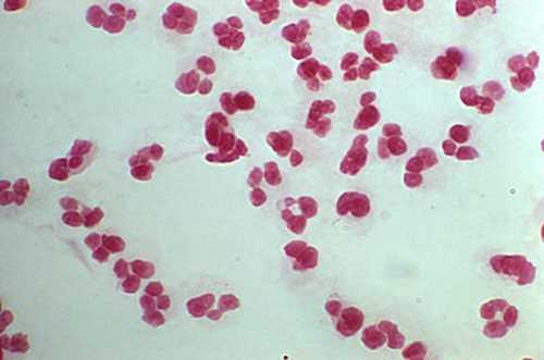 Neisseria gonorrhoeae