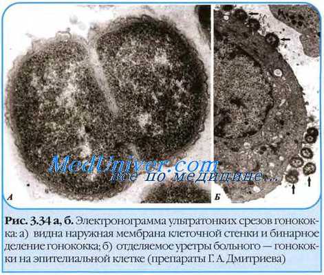 Гонококк (Neisseria gonorrhoeae)