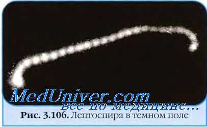 Культуральные свойства лептоспир. Патогенез лептоспирозов. Клиника лептоспирозов