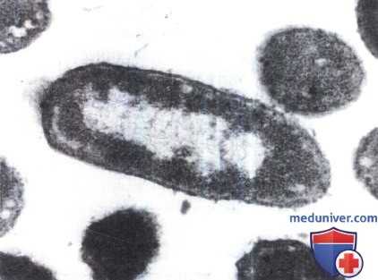 Род условно-патогенных энтеробактер (Enterobacter)