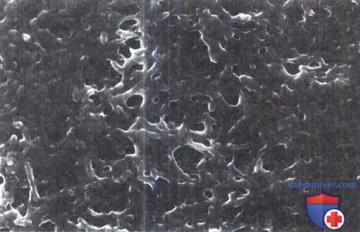 Род условно-патогенных серраций (Serratia)