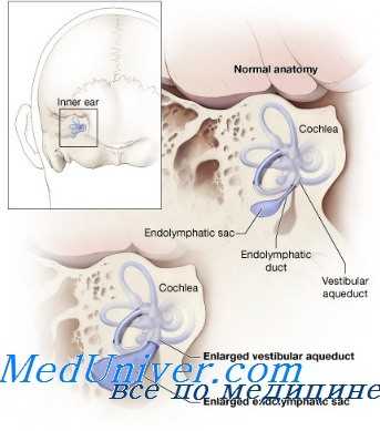 лабиринтопатии