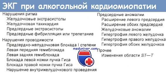 ЭКГ при алкогольной кардиомиопатии