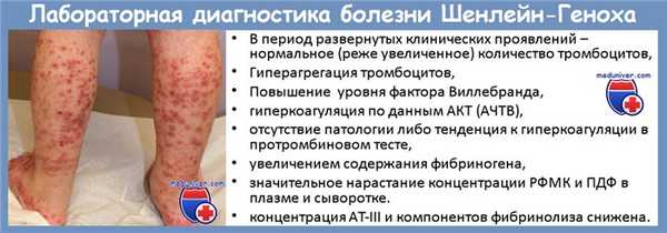 Диагностика болезни Шенлейн-Геноха