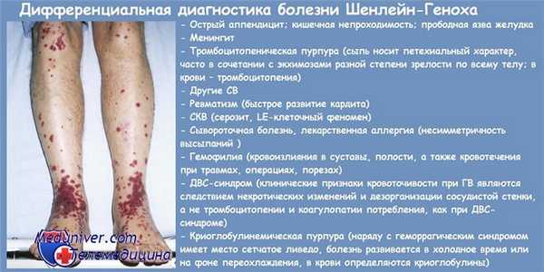 Дифференциальная диагностика болезни Шенлейн-Геноха