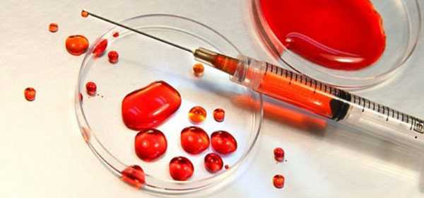 Плазмотерапия