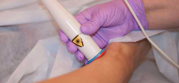 Лечение лазером