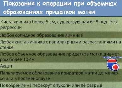 Показания к операции при объемных образованиях придатков матки