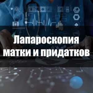 Лапароскопия матки и придатков